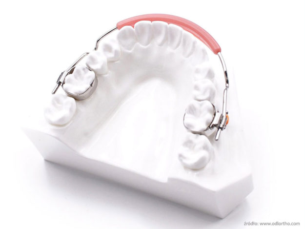 Wielokierunkowa-Jednoczesna-Rozbudowa-Łuków-Zębowych