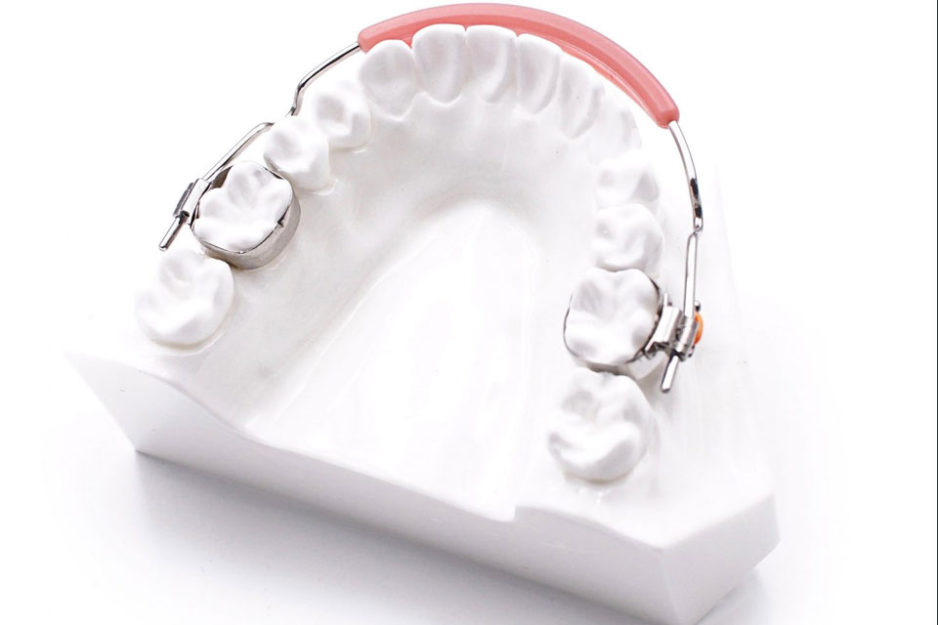 Wielokierunkowa-Jednoczesna-Rozbudowa-Łuków-Zębowych