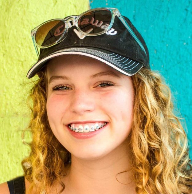 rodzaje-aparatów-ortodontycznych