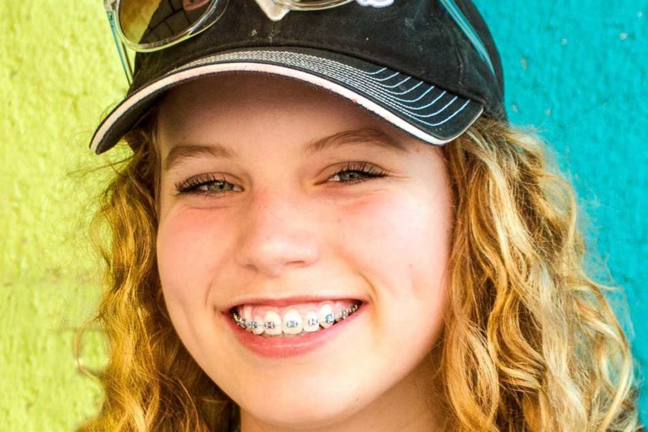 rodzaje-aparatów-ortodontycznych