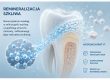 remineralizacja-szkliwa